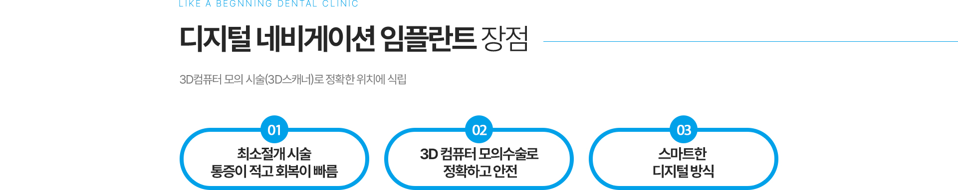 디지털 네비게이션 임플란트 장점