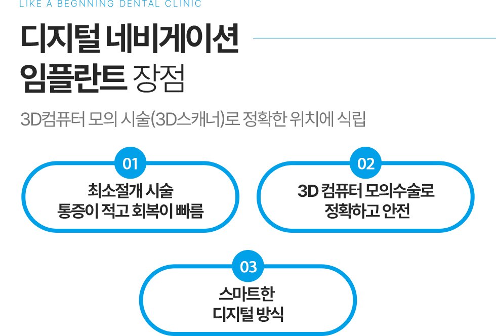 디지털 네비게이션 임플란트 장점